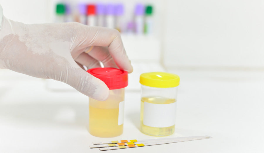 how to use urine test strips