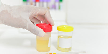 how to use urine test strips