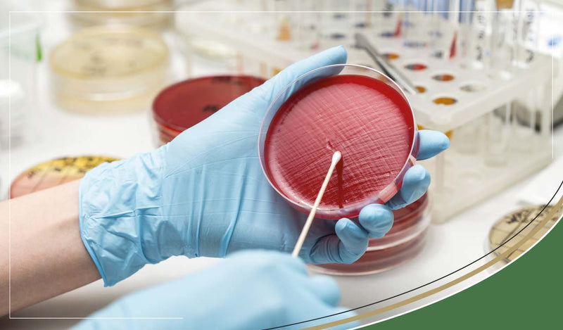 Urine Culture Test | Finding the Cause of UTI